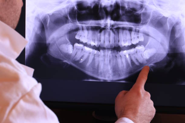 Best Emergency Root Canal Therapy in Allen, TX